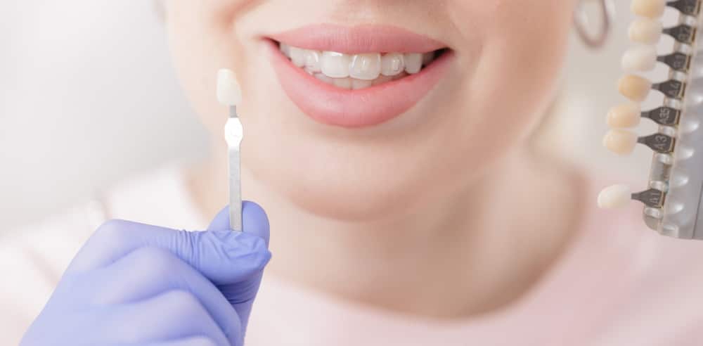 cosmetic dentistry dublin